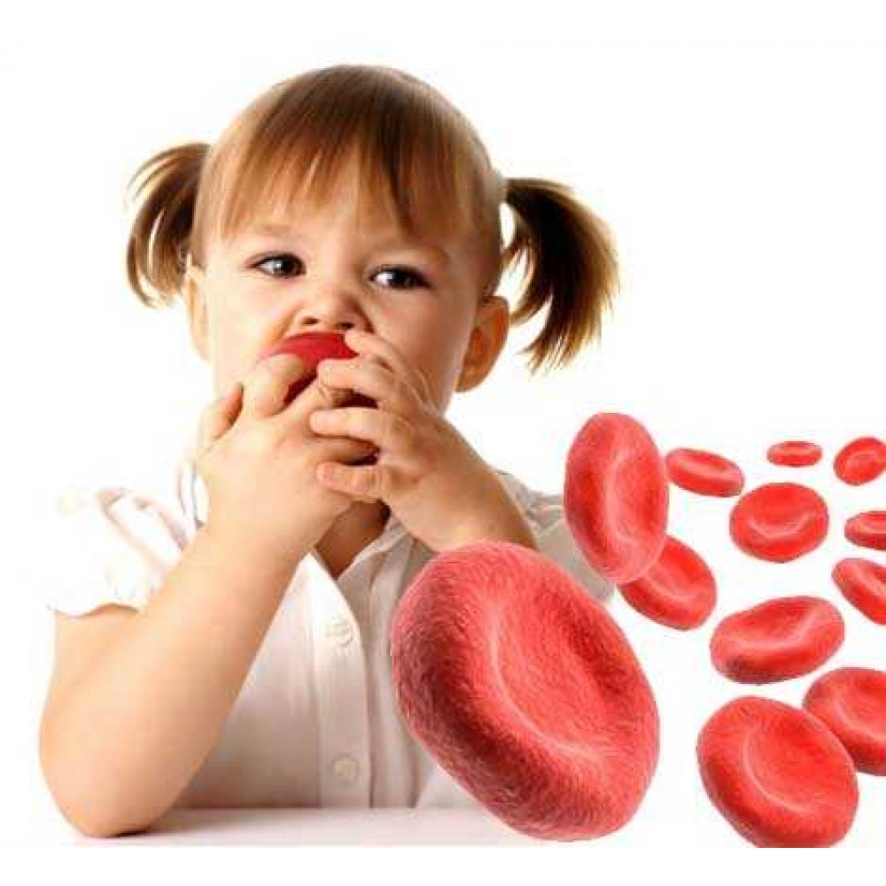 Анемия ухо. Железодефицитная анемия у детей. Жда у детей. Анемия у детей раннего возраста. Профилактика анемии у детей дошкольного возраста.