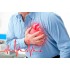 Диагностика и интенсивная терапия инфарктов миокарда – 36 ч.